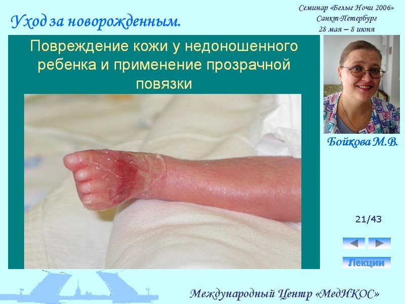 21/43 Лекции Уход за новорожденным. Бойкова М.В.